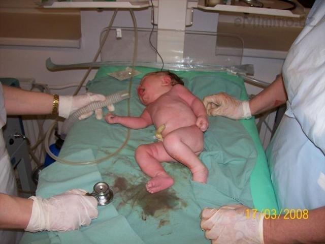 Kdy po porodu volat na pediatrii?