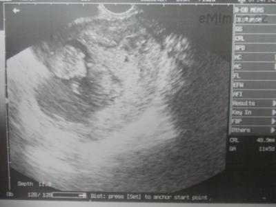 DSCN1587.JPG