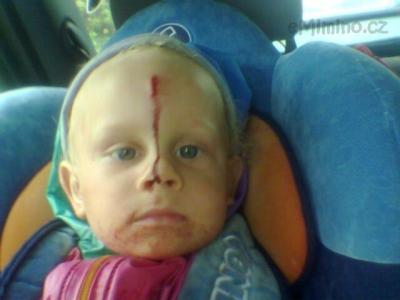 jedem na pohotovost :-(