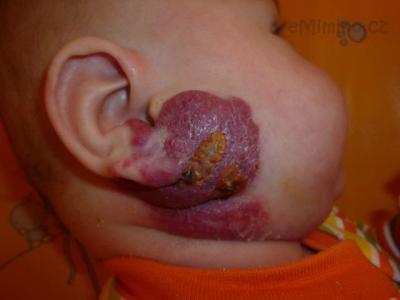 9.1.2012_zacatek lecby.JPG