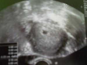 14727832_224.jpg