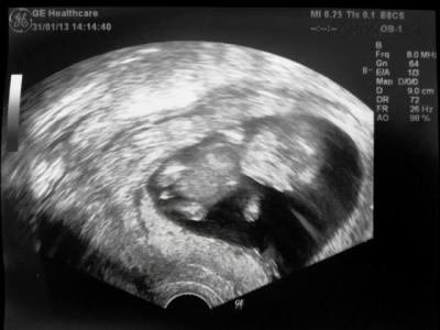 13weeks