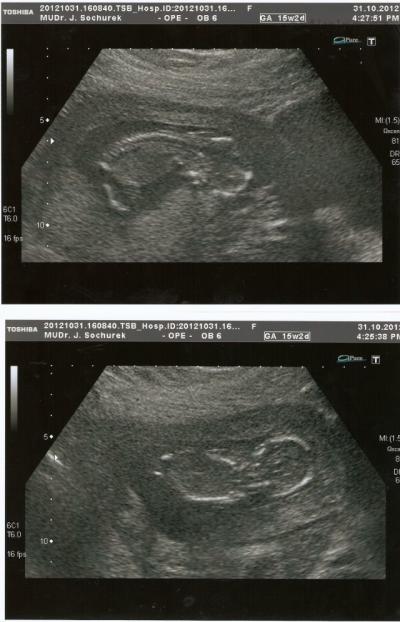 2 foto 13+6