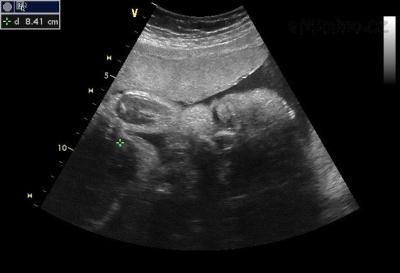 Miminko 21.3.2013.jpg