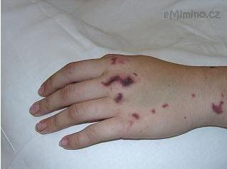 foto_nahled_46132.jpg