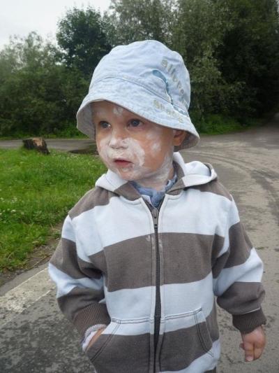 máme neštovice