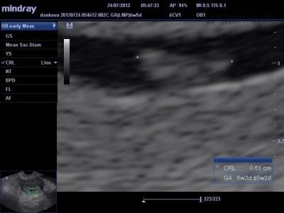 201207240547540001OB.jpg