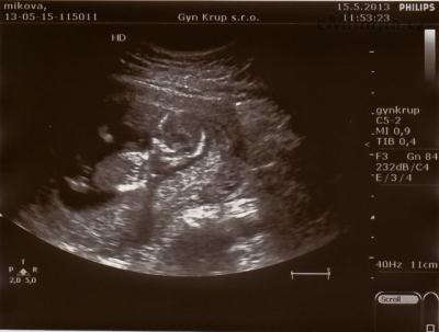 Mimi 5-1 – kopie.jpg