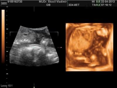 BABY_1.JPG