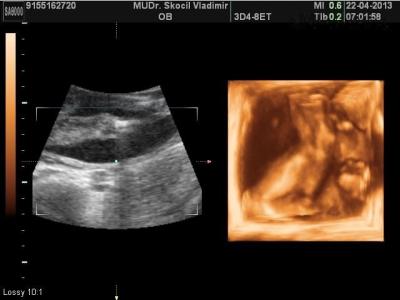 BABY_2.JPG