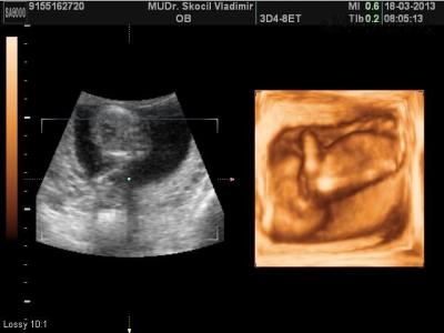 BABY_3.JPG
