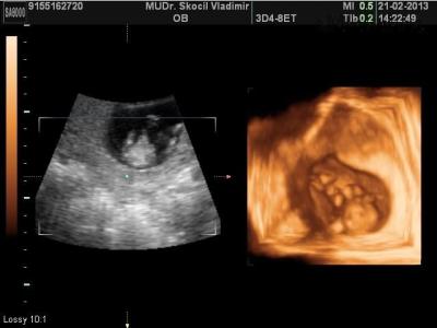 BABY_4.JPG