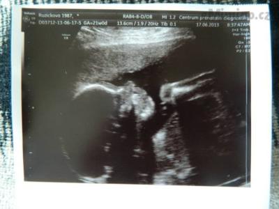 2.screening - 380g a 25cm