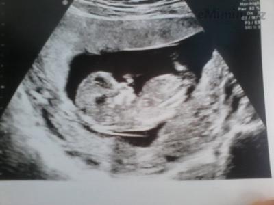 IMG_20130817_121552.jpg