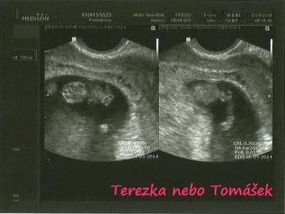 2,3cm.jpg
