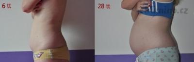 Bříško