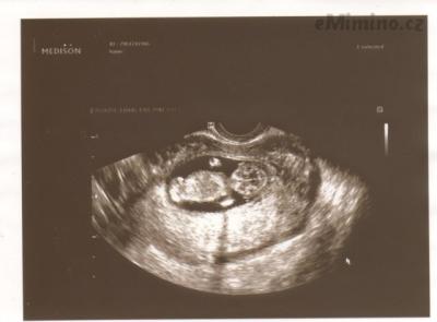 Scan-131105-0002.jpg