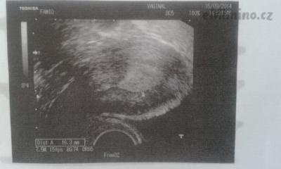 foto 003.jpg
