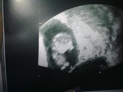 03092010180.jpg