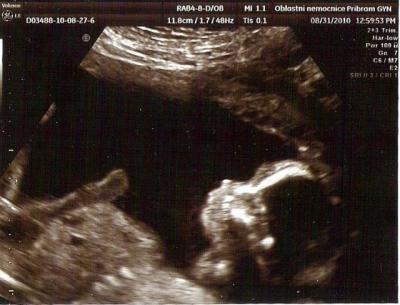 Scan0001.jpg