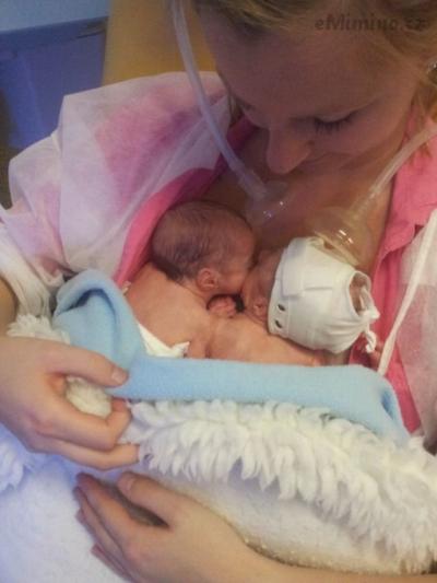 Na neonatologii