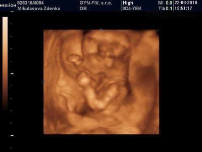 baby.jpg