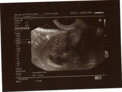 05-10-2010 15;28;18bez mena.jpg
