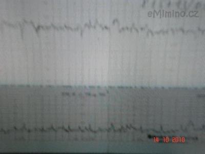 Monitor 14.10