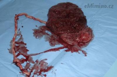 placenta.jpg