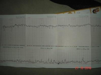 Monitor 21.10