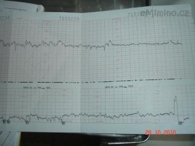 Monitor 28.10