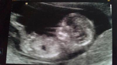 05112010076.jpg