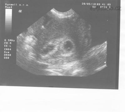 20.5.2010  5+2.jpg