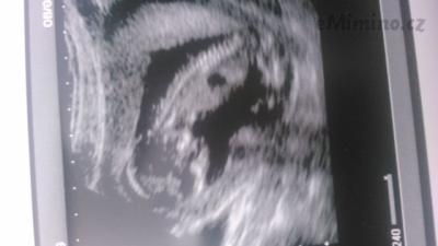 IMG-20150318-WA0000.jpeg