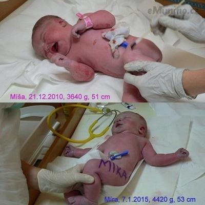 Misa a Mira