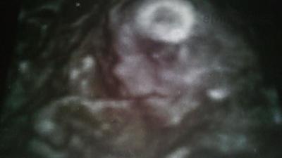 03112010496.JPG