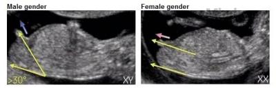 gender.jpg