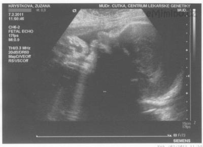 14. 7.2.2011 (33+1tt).jpg