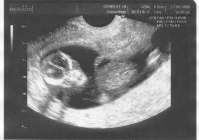 3. 17.9.2010 (12+5tt).jpg