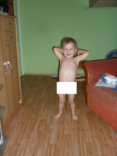 Má křivé nohy?