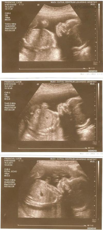 15.3.2011.jpg