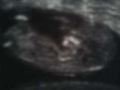 ultrazvuk 2.