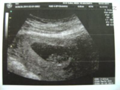 PICT2115.JPG