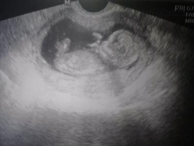 12. tyden:-*