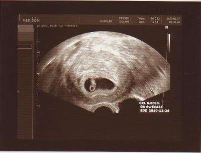 7.5.2010 6tt+5 t 0,8 cm   a máme i srdíčko.jpg