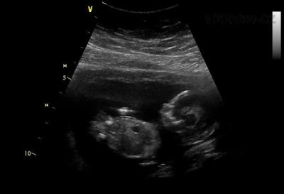 21.6. 14tt+0, dle UT 13tt+6 NT Screening 8,02 cm.jpg