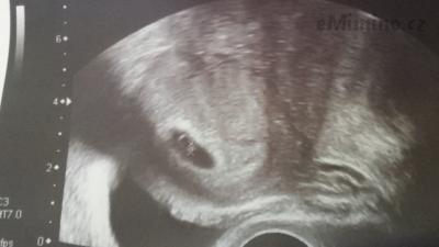 20160330_115111.jpg