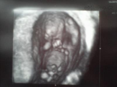 14.6. Genetika KV
