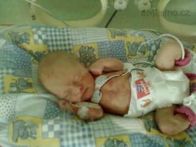 verunka neonatologie 005.jpg