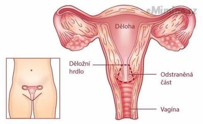chPymlaiPJ3a_s492x492.jpg